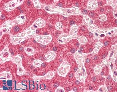 CDKN2B / p15 INK4b Antibody