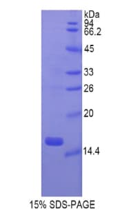 Rat GKN1 / Gastrokine 1 Protein (Recombinant His)