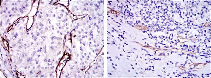 CD105 Antibody (clone 3A9)