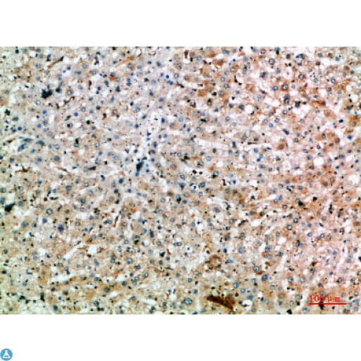 Polyclonal Rabbit anti-Human SPOP Antibody (WB)