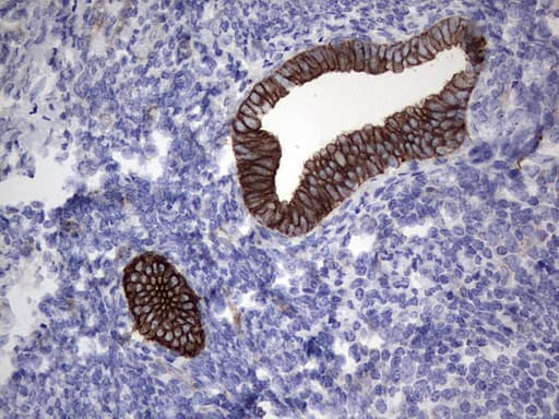 Monoclonal Rat anti-Human Acidic Cytokeratin Antibody (clone 9H3, IHC)
