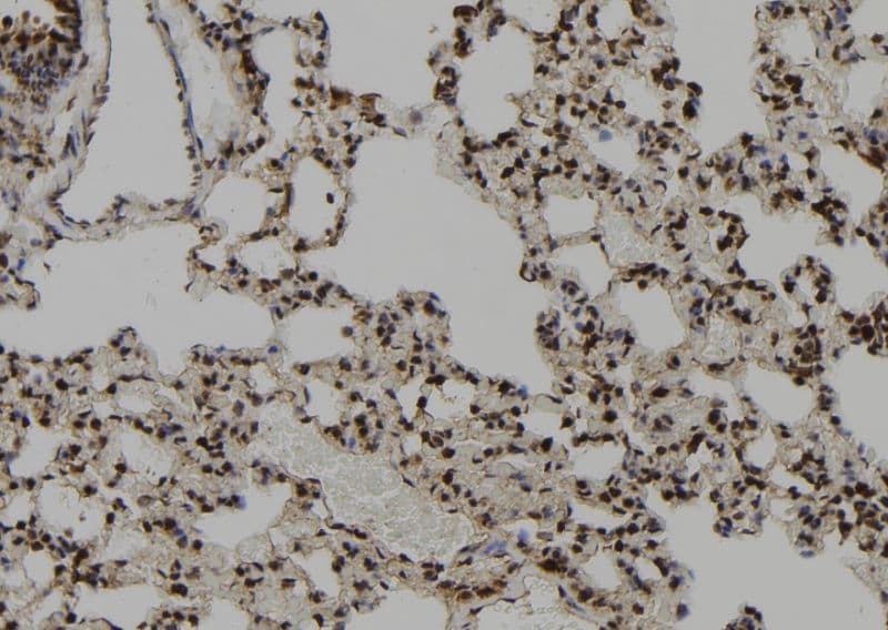 Polyclonal Rabbit anti-Human CEP164 Antibody (IHC, WB)
