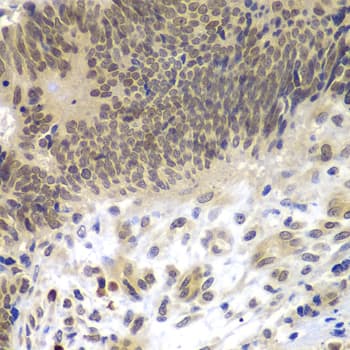 Polyclonal Rabbit anti-Human CEBPG / CEBP Gamma Antibody (IHC, IF, WB)