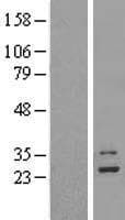 MRPL9 Protein (Over-Expression Lysate Myc-DDK (Flag))