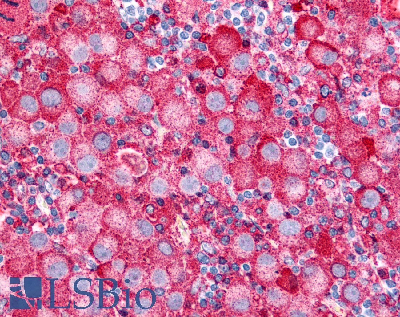 PathPlus™ VRL1 / TRPV2 Antibody (N-Terminus)