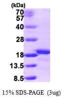 Human AIF1L Protein (Recombinant His)