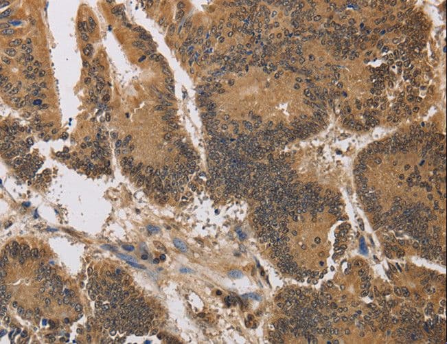 Polyclonal Rabbit anti-Human KV6.4 / KCNG4 Antibody (IHC, WB)