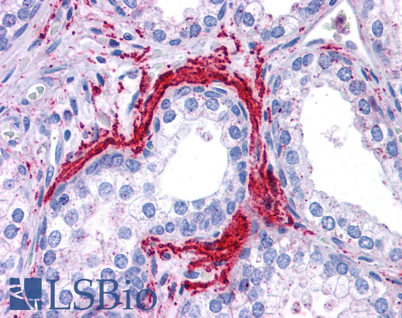 APG5 / ATG5 Antibody (C-Terminus)