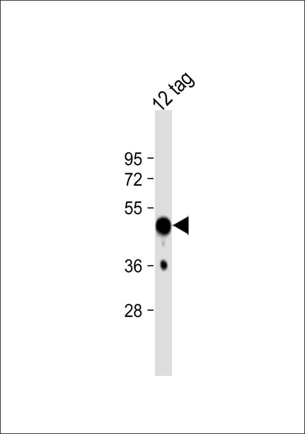 Polyclonal Rabbit HSV Tag Antibody (WB)