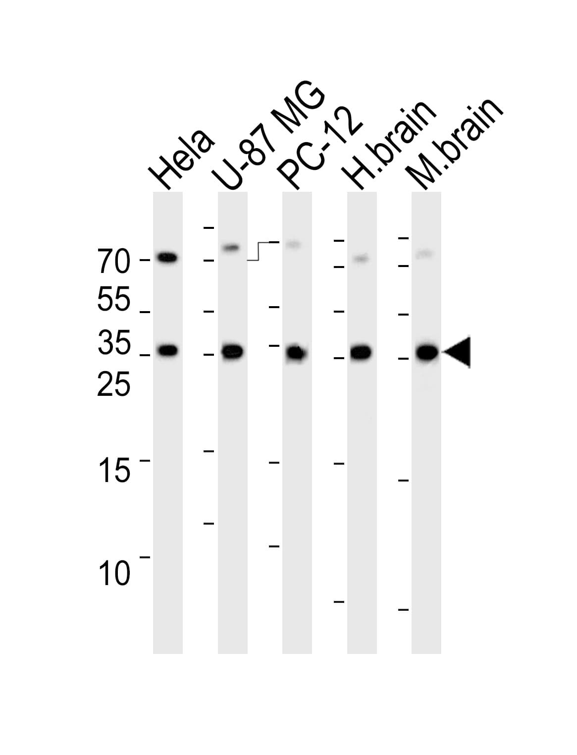 RAB35 Antibody (aa166-199)