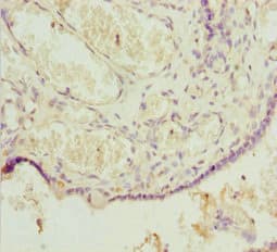 Polyclonal Rabbit anti-Human POU4F3 / BRN3C Antibody (IHC, WB)