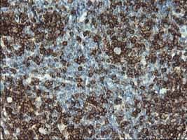 Monoclonal Mouse anti-Human CD2 Antibody (clone OTI9D1, IHC, WB)
