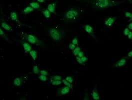 IHC-plus™ PGAM2 Antibody (clone 4E9)