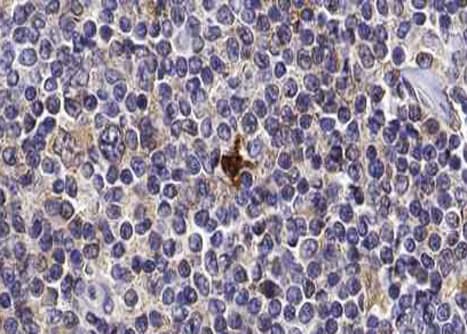 Polyclonal Rabbit anti-Human TOP2A / Topoisomerase II Alpha Antibody (IHC, IF, WB)