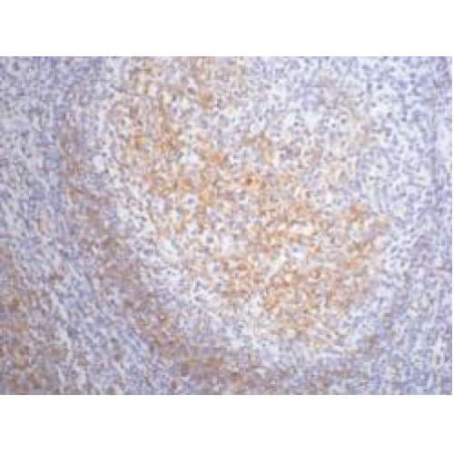 Monoclonal Mouse anti-Human FCER2 / CD23 Antibody (clone 1E9, IHC)