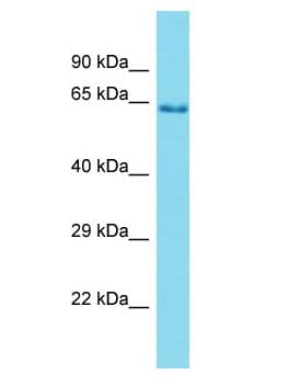 Polyclonal Rabbit anti-Human PRSS56 Antibody (aa452-501, WB)
