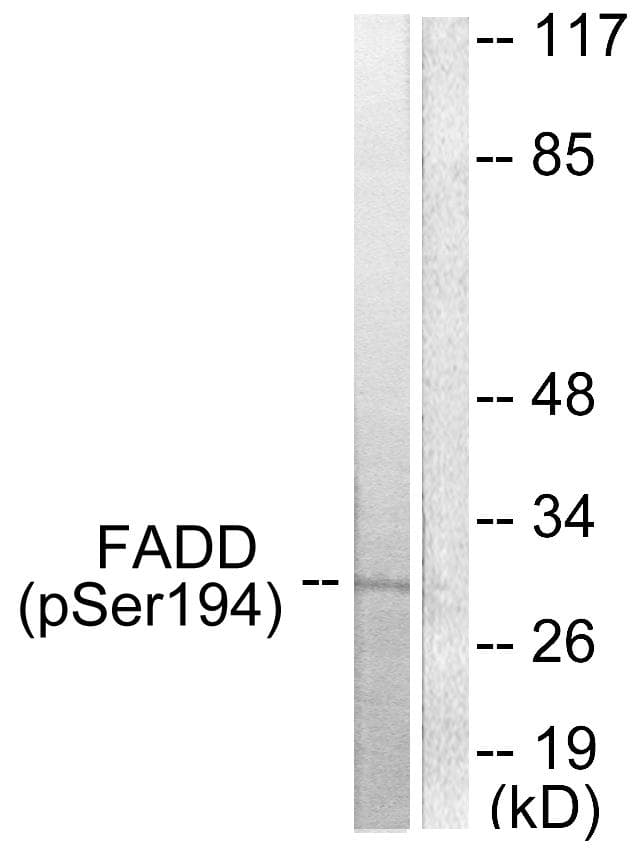 FADD Antibody (phospho-Ser194)