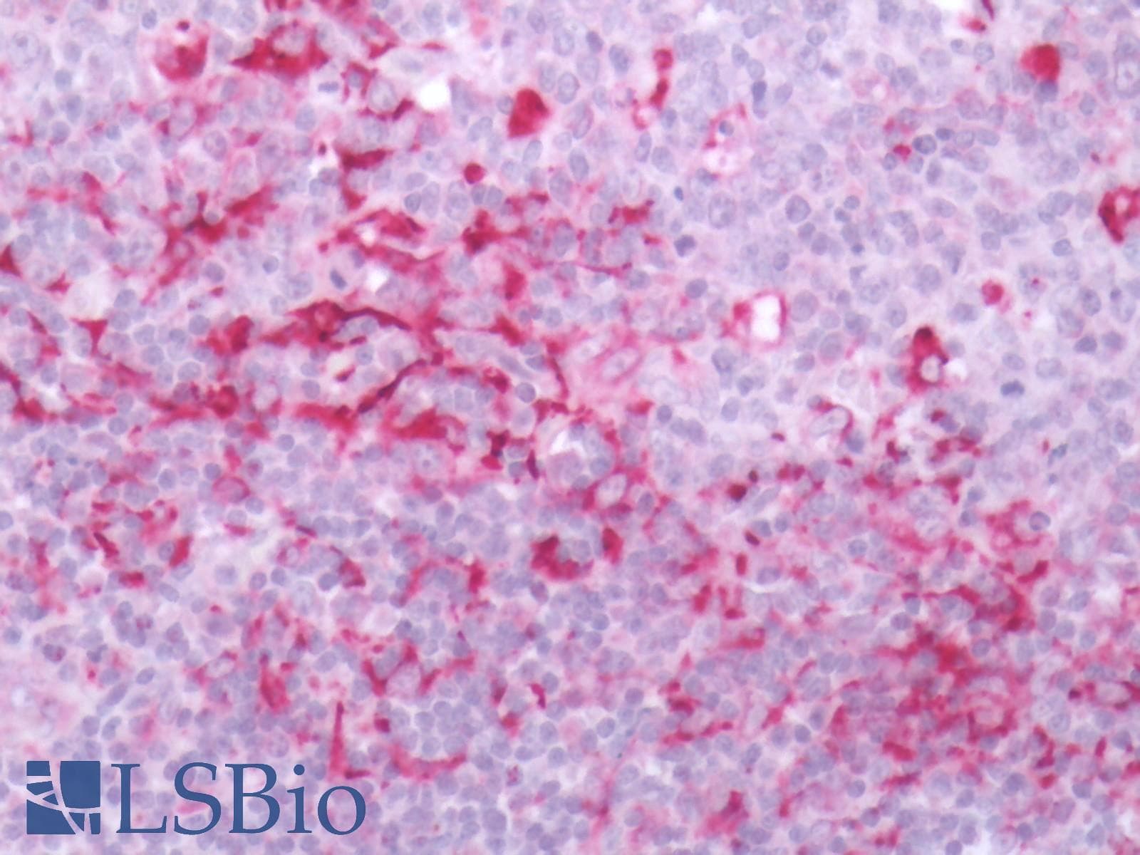 IHC-plus™ Polyclonal Rabbit anti-Human GPR171 Antibody (Extracellular Domain, IHC)