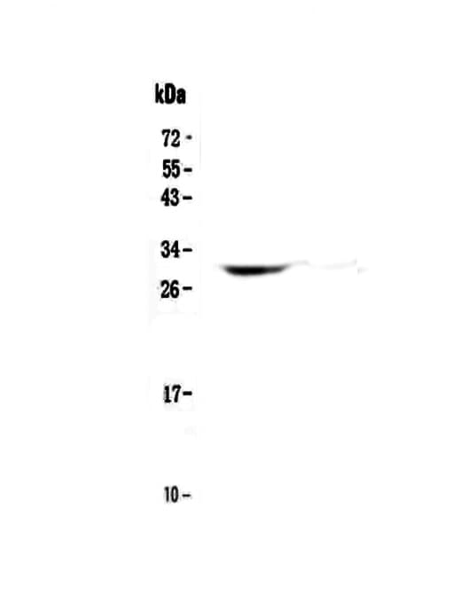 HLA-DQB1 Antibody