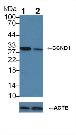 CCND1 / Cyclin D1 Antibody (aa1-295)