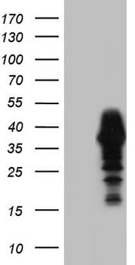 Monoclonal Mouse anti-Human NKX3-1 Antibody (clone OTI1B4, IHC, WB)