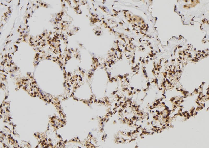 RNF2 / RING2 / RING1B Antibody