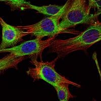 ABL2 Antibody (clone 1H1)