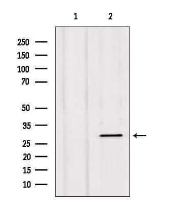 Polyclonal Rabbit anti-Human NXPH1 Antibody (IHC, WB)