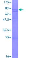 Human CENPI / CENP-I Protein (Recombinant GST)