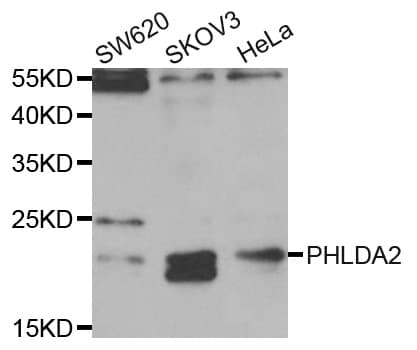 PHLDA2 / TSSC3 Antibody
