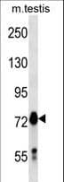 MARK4 Antibody (aa606-633)