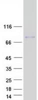Human GLDN / Gliomedin Protein (Recombinant Myc-DDK (Flag))