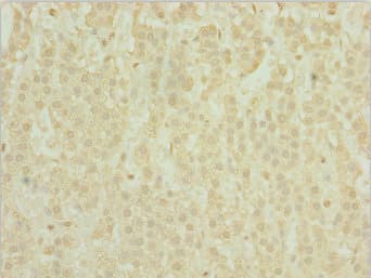 POC1A / SOFT Antibody