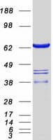 Human SWAP70 Protein (Recombinant Myc-DDK (Flag))