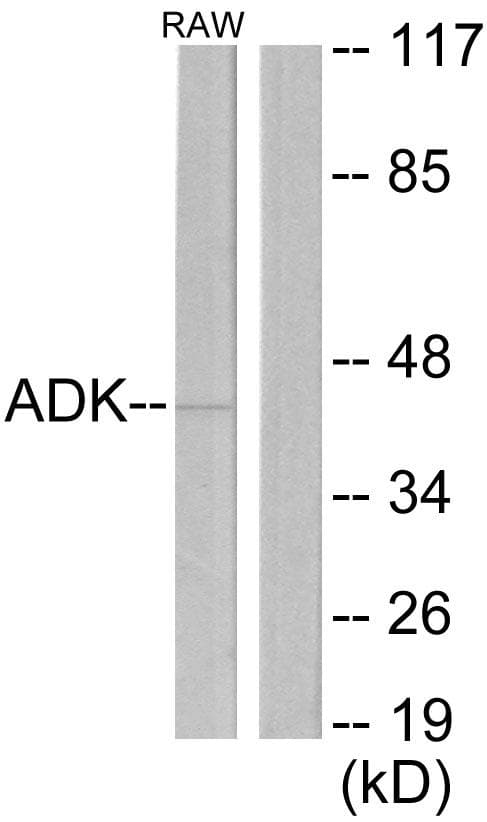 Polyclonal Rabbit anti-Human ADK / Adenosine Kinase Antibody (WB)