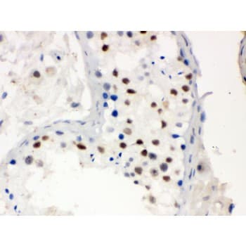 MNAT1 Antibody (aa92-278)