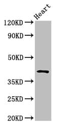 Polyclonal Rabbit anti-Human JAM3 Antibody (IHC, WB)