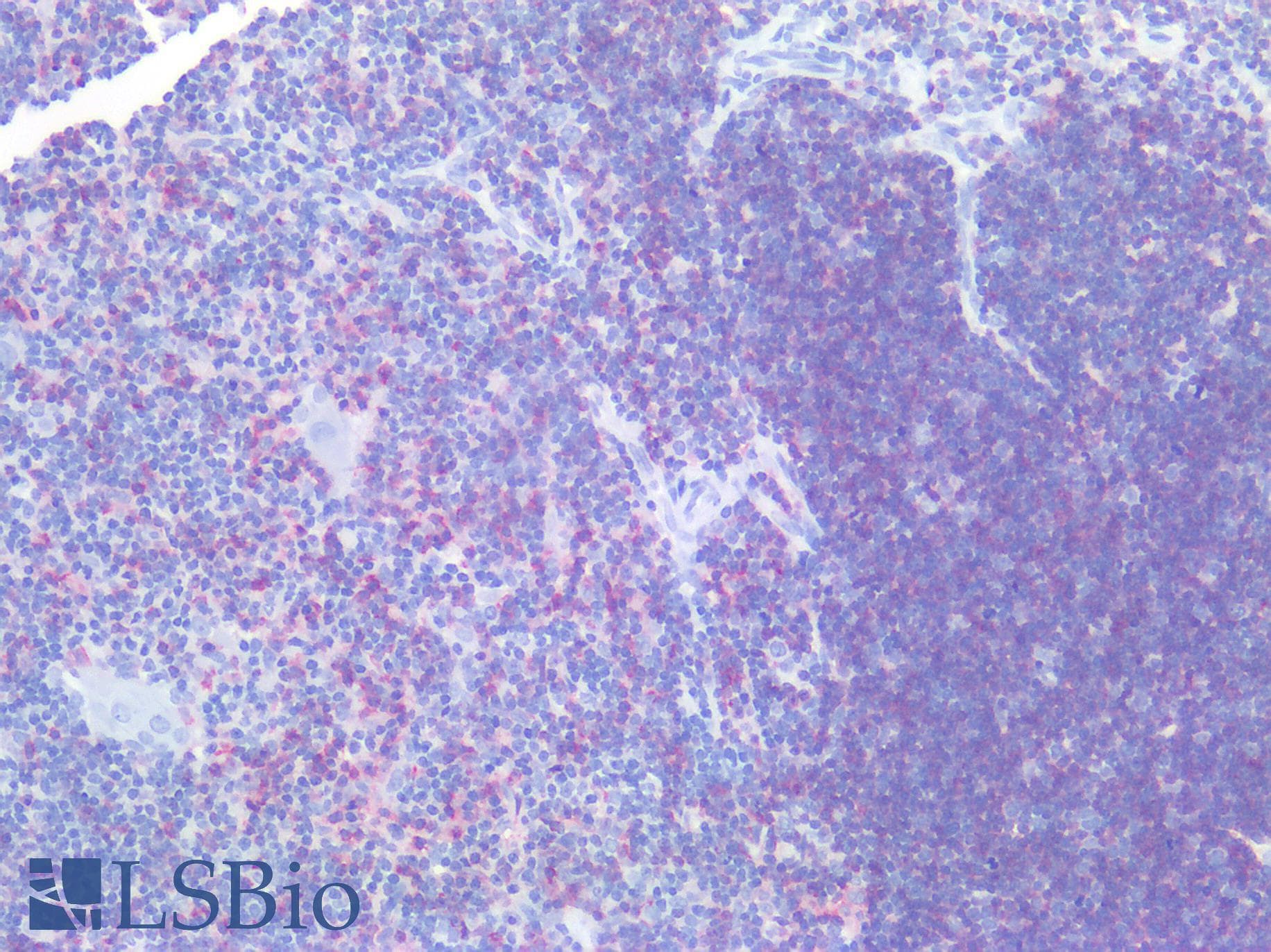 PathPlus™ Polyclonal Rabbit anti-Human CD8A / CD8 Alpha Antibody (clone P17-V, C-Terminus, IHC)