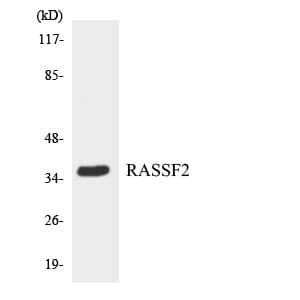 IHC-plus™ Polyclonal Rabbit anti-Human RASSF2 Antibody (aa93-142, IHC, WB)