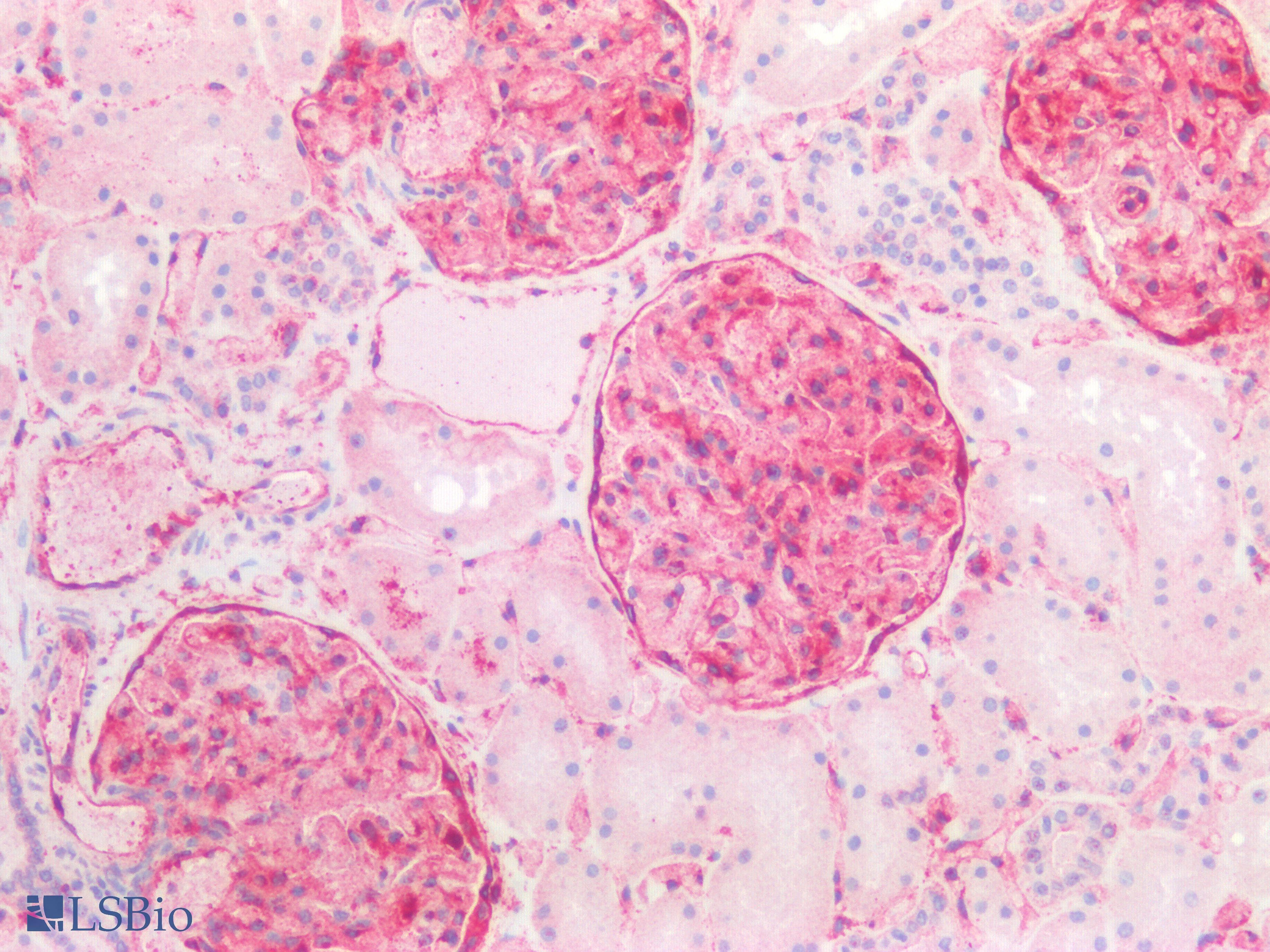 IHC-plus™ Polyclonal Rabbit anti-Human ANXA1 / Annexin A1 Antibody (Internal, IHC, IF, WB)