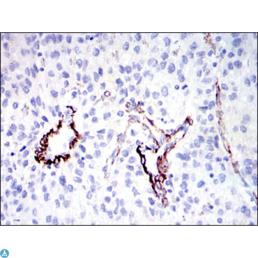 Monoclonal Mouse anti-Human DLGAP1 Antibody (IHC, IF, WB)