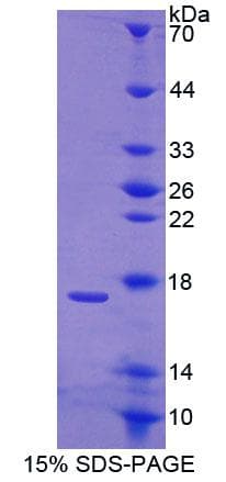 Human CABP / CABP1 Protein (Recombinant His-T7, N-terminus)