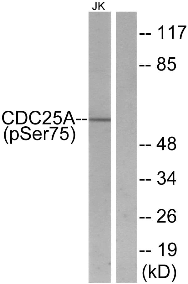 CDC25A Antibody (phospho-Ser75)