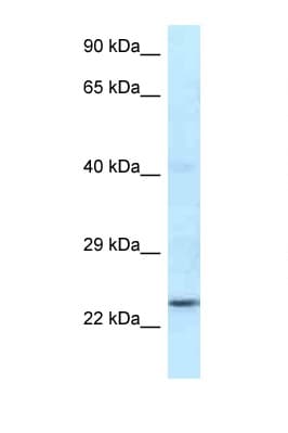 RNF141 Antibody (N-Terminus)