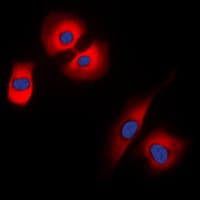 Polyclonal Rabbit anti-Human SYP / Synaptophysin Antibody (Internal, IF, WB)