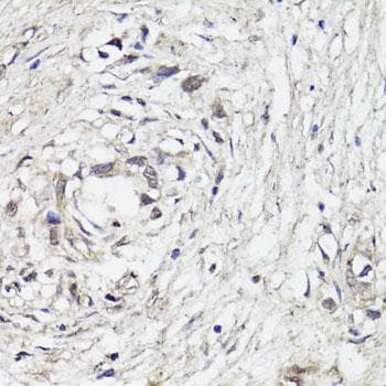 VEGFD Antibody