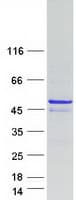 Human TMOD4 Protein (Recombinant Myc-DDK (Flag))