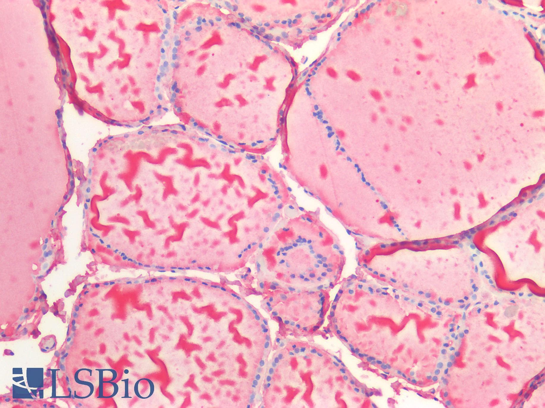 TG / Thyroglobulin Antibody (aa2083-2333)