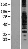 SYVN1 / HRD1 Protein (Over-Expression Lysate Myc-DDK (Flag))