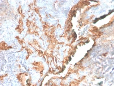 Recombinant Monoclonal Rabbit anti-Human TNC / Tenascin C Antibody (clone TNC/2981R, IHC)